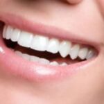 The Art of Veneajelu: Transforming Smiles One Treatment at a Time