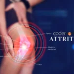Attrities: Understanding Joint Pain, Types, and Treatments